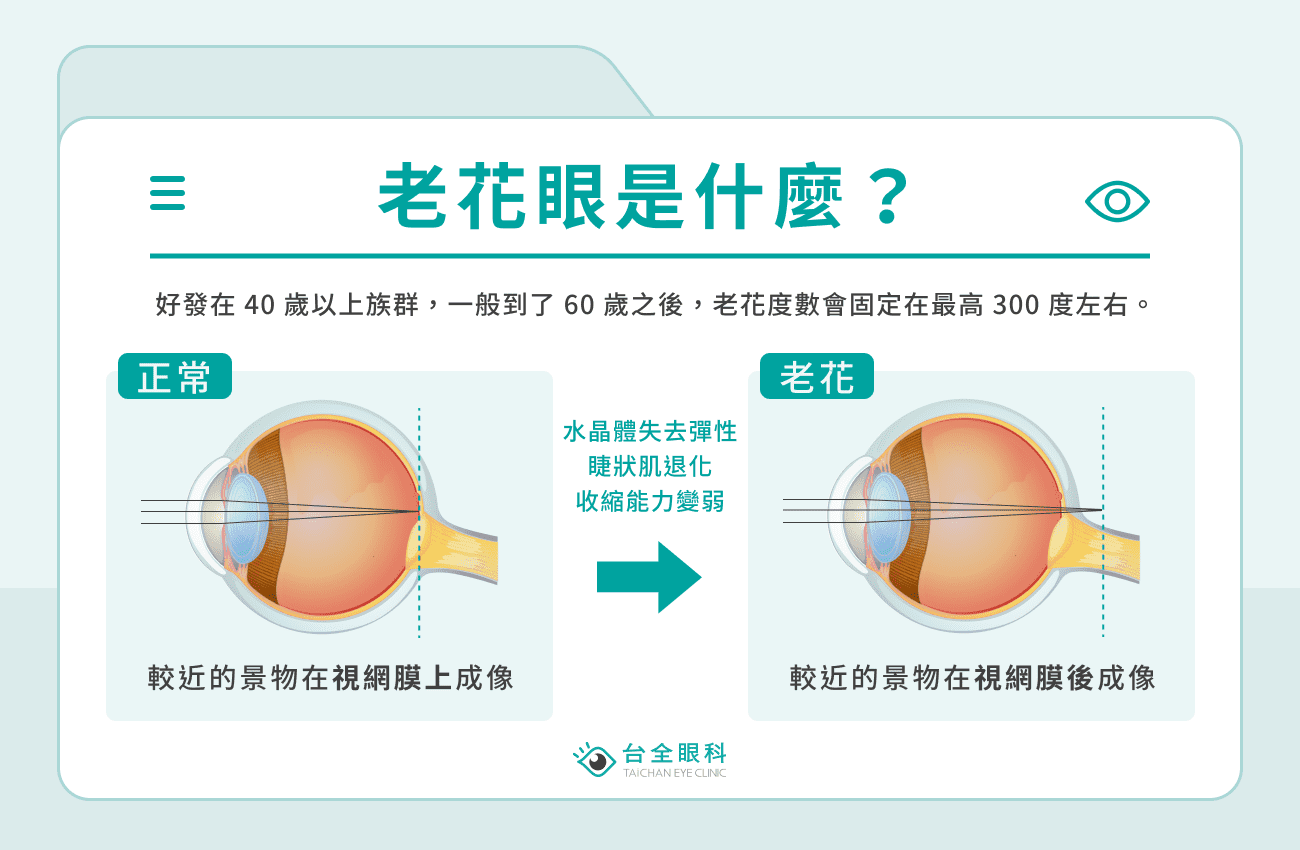 老花眼是什麼？