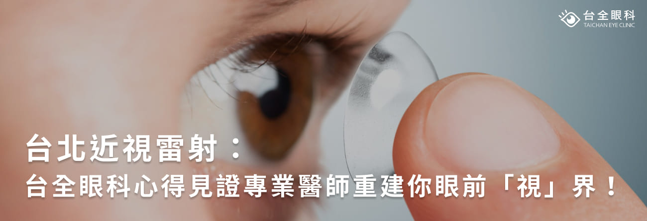 台北近視雷射：台全眼科心得見證，專業醫師重建你眼前「視」界！