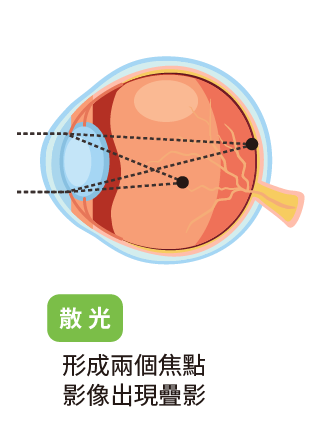 myopic-15